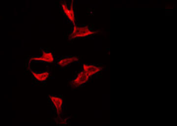 SEPT8 / Septin 8 Antibody - Staining HeLa cells by IF/ICC. The samples were fixed with PFA and permeabilized in 0.1% Triton X-100, then blocked in 10% serum for 45 min at 25°C. The primary antibody was diluted at 1:200 and incubated with the sample for 1 hour at 37°C. An Alexa Fluor 594 conjugated goat anti-rabbit IgG (H+L) Ab, diluted at 1/600, was used as the secondary antibody.