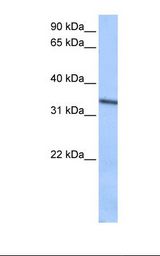 SEPT9 / Septin 9 Antibody - HepG2 cell lysate. Antibody concentration: 0.5 ug/ml. Gel concentration: 12%.  This image was taken for the unconjugated form of this product. Other forms have not been tested.