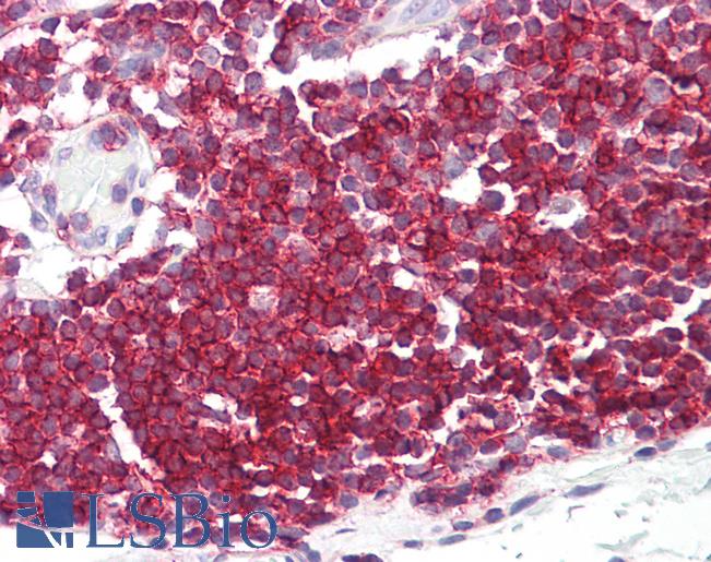 SEPT9 / Septin 9 Antibody - Anti-SEPT9 / Septin-9 antibody IHC of human colon, MALT. Immunohistochemistry of formalin-fixed, paraffin-embedded tissue after heat-induced antigen retrieval. Antibody dilution 2.5-5 ug/ml. This image was taken for the unconjugated form of this product. Other forms have not been tested.