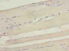 SEPW1 / Selenoprotein W Antibody - Immunohistochemistry of paraffin-embedded human skeletal muscle tissue using antibody at dilution of 1:100.
