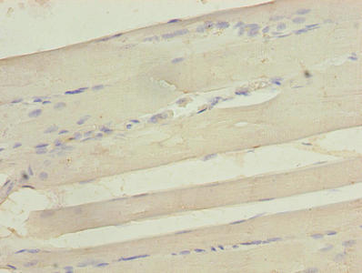 SEPW1 / Selenoprotein W Antibody - Immunohistochemistry of paraffin-embedded human skeletal muscle tissue using SEPW1 Antibody at dilution of 1:100