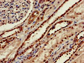 SEPX1 / Selenoprotein R Antibody - Immunohistochemistry image of paraffin-embedded human kidney tissue at a dilution of 1:100