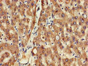SEPX1 / Selenoprotein R Antibody - Immunohistochemistry image of paraffin-embedded human liver tissue at a dilution of 1:100