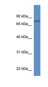 SERAC1 Antibody - SERAC1 antibody Western blot of Fetal Heart lysate.  This image was taken for the unconjugated form of this product. Other forms have not been tested.