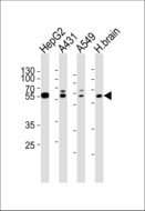 SERAC1 Antibody - Western blot of lysates from HepG2, A431, A549 cell line and human brain tissue lysate (from left to right) with SERAC1 Antibody. Antibody was diluted at 1:1000 at each lane. A goat anti-rabbit IgG H&L (HRP) at 1:5000 dilution was used as the secondary antibody. Lysates at 35 ug per lane.