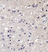 SERF1A / SERF1 Antibody - Immunohistochemistry: SERF1A Antibody - Analysis of SERF1A in human Alzheimer's brain using DAB with hematoxylin counterstain.  This image was taken for the unconjugated form of this product. Other forms have not been tested.