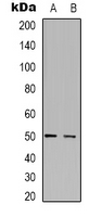 SERINC1 Antibody - Western blot analysis of SERINC1 expression in HEK293T (A); HepG2 (B) whole cell lysates.