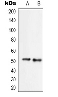 SERINC2 Antibody - Western blot analysis of SERINC2 expression in Jurkat (A); HepG2 (B) whole cell lysates.