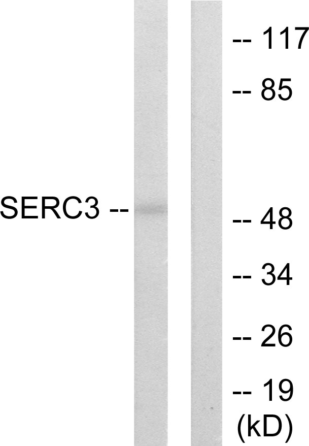 SERINC3 Antibody - Western blot analysis of lysates from 293 cells, using SERC3 Antibody. The lane on the right is blocked with the synthesized peptide.