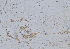 SERINC3 Antibody - 1:100 staining human lung tissue by IHC-P. The sample was formaldehyde fixed and a heat mediated antigen retrieval step in citrate buffer was performed. The sample was then blocked and incubated with the antibody for 1.5 hours at 22°C. An HRP conjugated goat anti-rabbit antibody was used as the secondary.