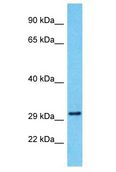 SERINC4 Antibody - SERINC4 antibody Western Blot of MCF7. Antibody dilution: 1 ug/ml.  This image was taken for the unconjugated form of this product. Other forms have not been tested.