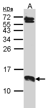 SERP1 Antibody - Sample (30 ug of whole cell lysate). A: A431 . 15% SDS PAGE. SERP1 antibody diluted at 1:1000.