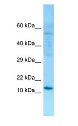 SERP1 Antibody - SERP1 antibody Western Blot of MCF7.  This image was taken for the unconjugated form of this product. Other forms have not been tested.