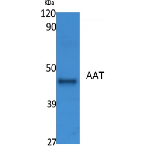 SERPINA1 / Alpha 1 Antitrypsin Antibody - Western blot of AAT antibody