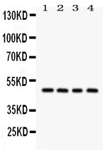 SERPINA1 / Alpha 1 Antitrypsin Antibody - SERPINA1 antibody Western blot. All lanes: Anti SERPINA1 at 0.5 ug/ml. Lane 1: Rat Testis Tissue Lysate at 50 ug. Lane 2: Mouse Testis Tissue Lysate at 50 ug. Lane 3: Rat Liver Tissue Lysate at 50 ug. Lane 4: Mouse Liver Tissue Lysate at 50 ug. Predicted band size: 47 kD. Observed band size: 47 kD.