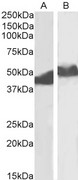 SERPINA1 / Alpha 1 Antitrypsin Antibody - SERPINA1 / Alpha 1 Antitrypsin antibody (0.01µg/ml) staining of Albumin-depleted Plasma (A) and Serum (B) lysates (35µg protein in RIPA buffer). Primary incubation was 1 hour. Detected by chemiluminescence.