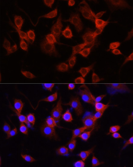 Anti-SERPINA1 / Alpha 1 Antitrypsin Antibody | Rabbit anti-Human | LSBio