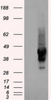 SERPINA1 / Alpha 1 Antitrypsin Antibody - A1AT antibody (3C5) at 1:2000 dilution + lysates from HEK-293T transfected with human A1AT expression vector.