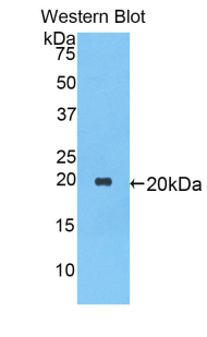 SERPINA1 / Alpha 1 Antitrypsin Antibody - Western blot of recombinant SERPINA1 / Alpha 1 Antitrypsin.  This image was taken for the unconjugated form of this product. Other forms have not been tested.