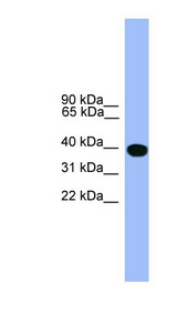 SERPINA1 / Alpha 1 Antitrypsin Antibody - SERPINA1 / Alpha-1-Antitrypsin antibody Western blot of Jurkat lysate. This image was taken for the unconjugated form of this product. Other forms have not been tested.