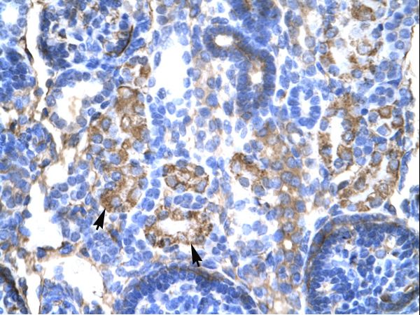 SERPINA1 / Alpha 1 Antitrypsin Antibody - SERPINA1 / Alpha-1-Antitrypsin antibody AVARP00015_T100-NP_000286-SERPINA1 Antibody was used in IHC to stain formalin-fixed, paraffin-embedded human kidney.  This image was taken for the unconjugated form of this product. Other forms have not been tested.