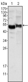 SERPINA1 / Alpha 1 Antitrypsin Antibody - alpha-1 Antitrypsin Antibody in Western Blot (WB)
