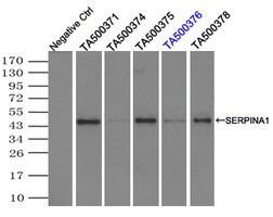 SERPINA1 / Alpha 1 Antitrypsin Antibody - Immunoprecipitation(IP) of SERPINA1 by using monoclonal anti-SERPINA1 antibodies (Negative control: IP without adding anti-SERPINA1 antibody.). For each experiment, 500ul of DDK tagged SERPINA1 overexpression lysates (at 1:5 dilution with HEK293T lysate), 2 ug of anti-SERPINA1 antibody and 20ul (0.1 mg) of goat anti-mouse conjugated magnetic beads were mixed and incubated overnight. After extensive wash to remove any non-specific binding, the immuno-precipitated products were analyzed with rabbit anti-DDK polyclonal antibody.