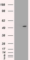 SERPINA1 / Alpha 1 Antitrypsin Antibody - HEK293T cells were transfected with the pCMV6-ENTRY control (Left lane) or pCMV6-ENTRY SERPINA1 (Right lane) cDNA for 48 hrs and lysed. Equivalent amounts of cell lysates (5 ug per lane) were separated by SDS-PAGE and immunoblotted with anti-SERPINA1.