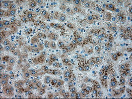 SERPINA1 / Alpha 1 Antitrypsin Antibody - IHC of paraffin-embedded liver tissue using anti-SERPINA1 mouse monoclonal antibody. (Dilution 1:50).