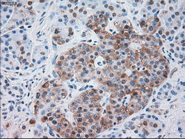 SERPINA1 / Alpha 1 Antitrypsin Antibody - IHC of paraffin-embedded pancreas tissue using anti-SERPINA1 mouse monoclonal antibody. (Dilution 1:50).