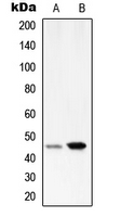 SERPINA1 / Alpha 1 Antitrypsin Antibody - Western blot analysis of Serpin A1 expression in HepG2 (A); HeLa (B) whole cell lysates.