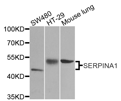 SERPINA1 / Alpha 1 Antitrypsin Antibody - Western blot analysis of extracts of various cell lines, using SERPINA1 antibody at 1:1000 dilution. The secondary antibody used was an HRP Goat Anti-Rabbit IgG (H+L) at 1:10000 dilution. Lysates were loaded 25ug per lane and 3% nonfat dry milk in TBST was used for blocking.