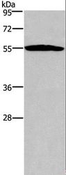 SERPINA1 / Alpha 1 Antitrypsin Antibody - Western blot analysis of Human serum solution, using SERPINA1 Polyclonal Antibody at dilution of 1:250.