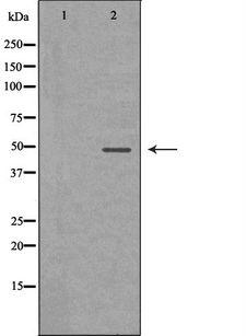 SERPINA1 / Alpha 1 Antitrypsin Antibody - Western blot analysis of mouse lung lysate using SERPINA1 antibody. The lane on the left is treated with the antigen-specific peptide.