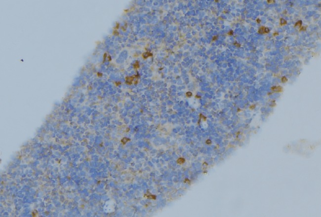 SERPINA1 / Alpha 1 Antitrypsin Antibody - 1:100 staining human lymph node tissue by IHC-P. The sample was formaldehyde fixed and a heat mediated antigen retrieval step in citrate buffer was performed. The sample was then blocked and incubated with the antibody for 1.5 hours at 22°C. An HRP conjugated goat anti-rabbit antibody was used as the secondary.