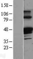 SERPINA1 / Alpha 1 Antitrypsin Protein - Western validation with an anti-DDK antibody * L: Control HEK293 lysate R: Over-expression lysate
