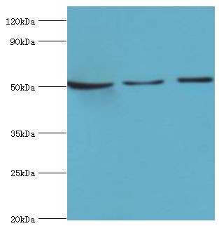 SERPINA10 / PZI Antibody - Western blot. All lanes: Protein Z-dependent protease inhibitor antibody at 3 ug/ml. Lane 1: mouse liver tissue. Lane 2: HepG2 whole cell lysate. Lane 3: LO2 whole cell lysate. secondary Goat polyclonal to rabbit at 1:10000 dilution. Predicted band size: 51 kDa. Observed band size: 51 kDa.