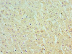 SERPINA10 / PZI Antibody - Immunohistochemistry of paraffin-embedded human liver using antibody at 1:100 dilution.