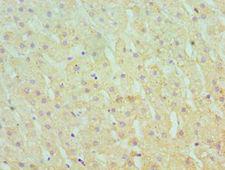SERPINA10 / PZI Antibody - Immunohistochemistry of paraffin-embedded human liver using antibody at 1:100 dilution.