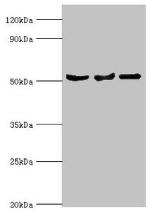 SERPINA10 / PZI Antibody - Western blot All lanes: Protein Z-dependent protease inhibitor antibody at 3µg/ml Lane 1: Mouse liver tissue Lane 2: HepG2 whole cell lysate Lane 3: LO2 whole cell lysate Secondary Goat polyclonal to rabbit IgG at 1/10000 dilution Predicted band size: 51 kDa Observed band size: 51 kDa