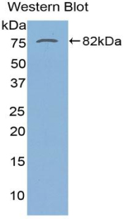 SERPINA10 / PZI Antibody - Western blot of recombinant SERPINA10 / PZI.