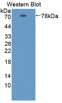 SERPINA10 / PZI Antibody - Western blot of SERPINA10 / PZI antibody.