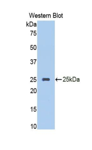 SERPINA10 / PZI Antibody - Western blot of recombinant SERPINA10 / PZI.  This image was taken for the unconjugated form of this product. Other forms have not been tested.