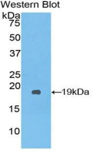 SERPINA10 / PZI Antibody - Western Blot; Sample: Recombinant protein.