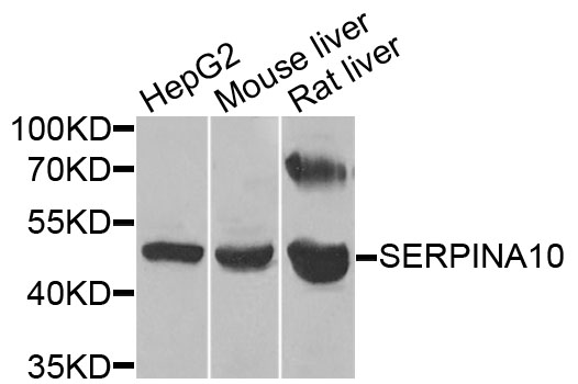 SERPINA10 / PZI Antibody - Western blot analysis of extracts of various cells.
