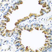 SERPINA10 / PZI Antibody - Immunohistochemistry of paraffin-embedded mouse lung tissue.