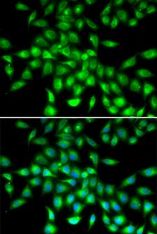 SERPINA10 / PZI Antibody - Immunofluorescence analysis of A549 cells.