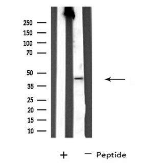 SERPINA11 Antibody - Western blot analysis of extracts of HT29 cells using SERPINA11 antibody.