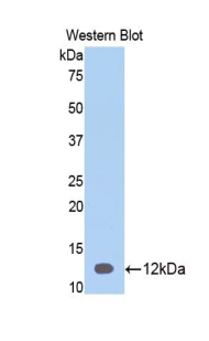SERPINA12 / Vaspin Antibody - Western blot of recombinant SERPINA12 / Vaspin.  This image was taken for the unconjugated form of this product. Other forms have not been tested.