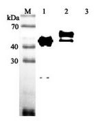 SERPINA12 / Vaspin Antibody - Western blot analysis using anti-Vaspin (human), pAb at 1:2000 dilution. 1: Human Vaspin (His-tagged). 2: Human Vaspin (FLAG-tagged) (negative control).